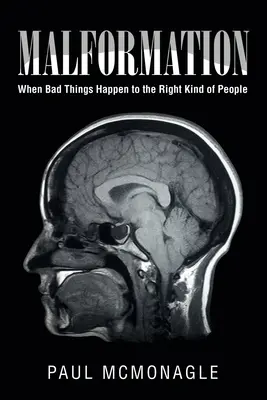 Malformación: Cuando las cosas malas le ocurren a la gente adecuada - Malformation: When Bad Things Happen to the Right Kind of People