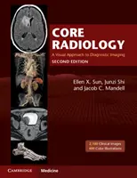 Radiología básica: Un enfoque visual del diagnóstico por imagen - Core Radiology: A Visual Approach to Diagnostic Imaging