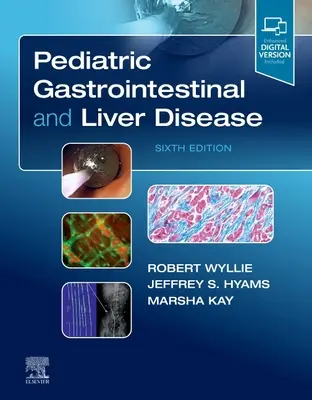 Enfermedades gastrointestinales y hepáticas pediátricas - Pediatric Gastrointestinal and Liver Disease