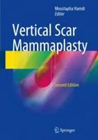 Mamoplastia de cicatriz vertical - Vertical Scar Mammaplasty