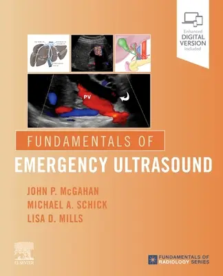 Fundamentos de Ecografía de Urgencia - Fundamentals of Emergency Ultrasound