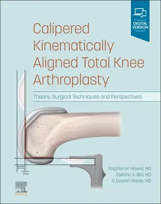 Artroplastia total de rodilla alineada cinemáticamente: Teoría, técnicas quirúrgicas y perspectivas - Calipered Kinematically Aligned Total Knee Arthroplasty: Theory, Surgical Techniques and Perspectives