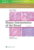 Interpretación de la biopsia de mama - Biopsy Interpretation of the Breast