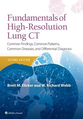 Fundamentos de la TC pulmonar de alta resolución: hallazgos comunes, patrones comunes, enfermedades comunes y diagnóstico diferencial - Fundamentals of High-Resolution Lung CT: Common Findings, Common Patterns, Common Diseases and Differential Diagnosis