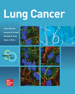 Cáncer de pulmón: Estándares de atención - Lung Cancer: Standards of Care