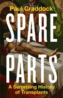 Piezas de repuesto - Una sorprendente historia de trasplantes - Spare Parts - A Surprising History of Transplants