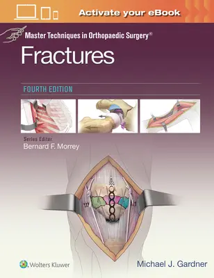 Técnicas magistrales en cirugía ortopédica: Fracturas - Master Techniques in Orthopaedic Surgery: Fractures