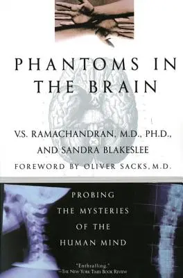 Fantasmas en el cerebro - Phantoms in the Brain