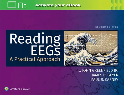 Lectura de electroencefalogramas: Un enfoque práctico - Reading Eegs: A Practical Approach