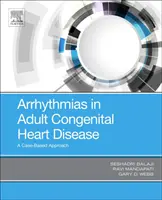 Arritmias en Cardiopatías Congénitas del Adulto: Un enfoque basado en casos - Arrhythmias in Adult Congenital Heart Disease: A Case-Based Approach