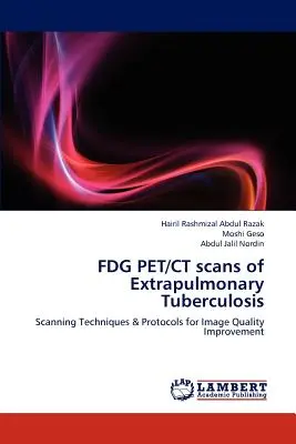 FDG PET/CT en la tuberculosis extrapulmonar - FDG PET/CT scans of Extrapulmonary Tuberculosis