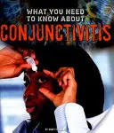 Lo que hay que saber sobre la conjuntivitis - What You Need to Know about Conjunctivitis