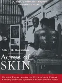 Acres de piel: Experimentos humanos en la prisión de Holmesburg - Acres of Skin: Human Experiments at Holmesburg Prison