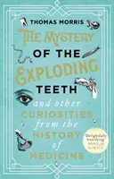 El Misterio de los Dientes Explosivos y Otras Curiosidades de la Historia de la Medicina - Mystery of the Exploding Teeth and Other Curiosities from the History of Medicine