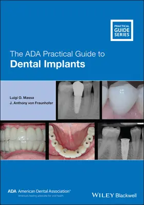 Guía práctica de implantes dentales de la ADA - The ADA Practical Guide to Dental Implants
