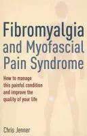 Fibromialgia y síndrome de dolor miofascial - Fibromyalgia and Myofascial Pain Syndrome