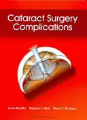 Complicaciones de la cirugía de cataratas - Cataract Surgery Complications