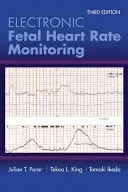 Monitorización electrónica de la frecuencia cardiaca fetal: El sistema de 5 niveles: El sistema de 5 niveles - Electronic Fetal Heart Rate Monitoring: The 5-Tier System: The 5-Tier System