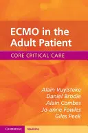 ECMO en el paciente adulto - ECMO in the Adult Patient