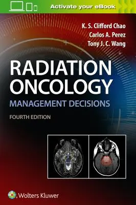 Decisiones de gestión en oncología radioterápica - Radiation Oncology Management Decisions