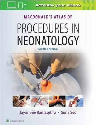 Atlas Macdonald de Procedimientos en Neonatología - Macdonald's Atlas of Procedures in Neonatology