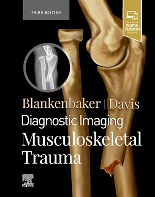 Diagnóstico por imagen: Musculoskeletal Trauma - Diagnostic Imaging: Musculoskeletal Trauma