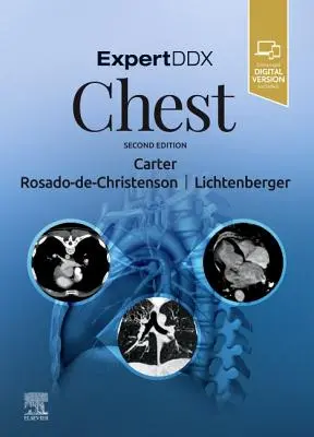 ExpertDDx: Tórax - ExpertDDx: Chest