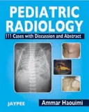 Radiología Pediátrica - 111 Casos con Discusión y Resumen - Pediatric Radiology - 111 Cases with Discussion and Abstract