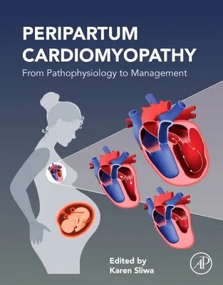 Peripartum Cardiomyopathy: De la Fisiopatología al Manejo - Peripartum Cardiomyopathy: From Pathophysiology to Management