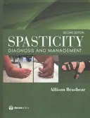 Espasticidad: Diagnóstico y tratamiento - Spasticity: Diagnosis and Management