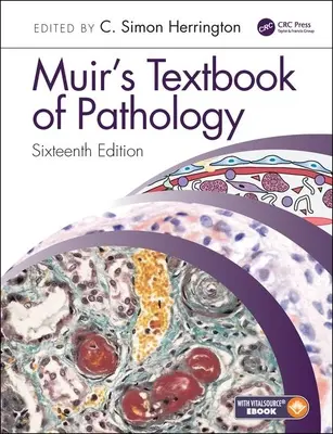 Libro de texto de patología de Muir - Muir's Textbook of Pathology