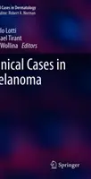 Casos clínicos de melanoma - Clinical Cases in Melanoma