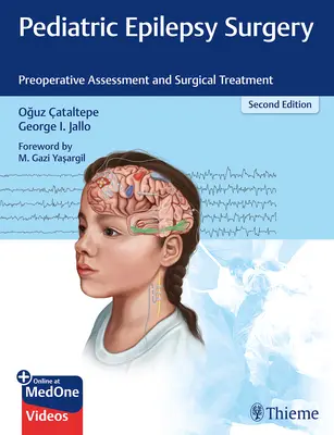 Cirugía de la epilepsia pediátrica: Evaluación preoperatoria y tratamiento quirúrgico - Pediatric Epilepsy Surgery: Preoperative Assessment and Surgical Treatment