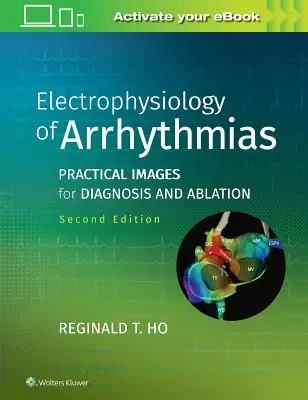 Electrofisiología de las arritmias: Imágenes prácticas para el diagnóstico y la ablación - Electrophysiology of Arrhythmias: Practical Images for Diagnosis and Ablation