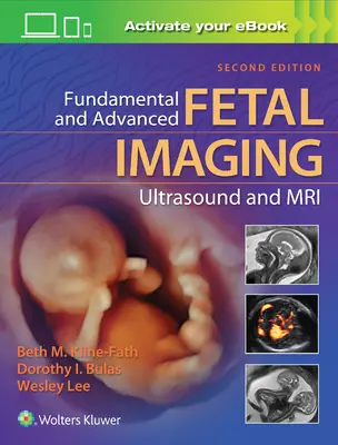 Fundamental and Advanced Fetal Imaging Ultrasound and MRI (Ecografía y resonancia magnética fetal fundamental y avanzada) - Fundamental and Advanced Fetal Imaging Ultrasound and MRI