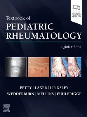 Textbook of Pediatric Rheumatology (Libro de texto de reumatología pediátrica) - Textbook of Pediatric Rheumatology