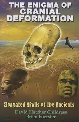 El enigma de la deformación craneal: Cráneos alargados de los antiguos - The Enigma of Cranial Deformation: Elongated Skulls of the Ancients