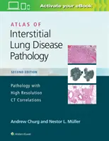 Atlas de patología de la enfermedad pulmonar intersticial - Atlas of Interstitial Lung Disease Pathology