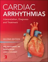 Arritmias cardíacas: Interpretación, diagnóstico y tratamiento, segunda edición - Cardiac Arrhythmias: Interpretation, Diagnosis and Treatment, Second Edition