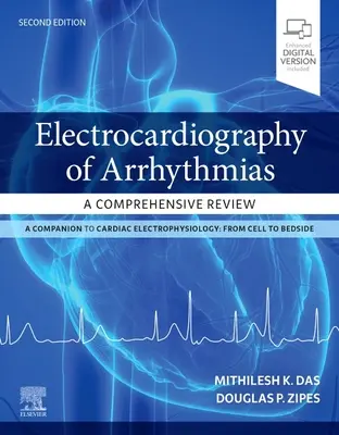 Electrocardiografía de las Arritmias: Una revisión exhaustiva - Electrocardiography of Arrhythmias: A Comprehensive Review