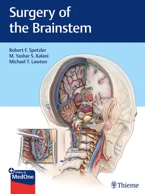 Cirugía del tronco encefálico - Surgery of the Brainstem