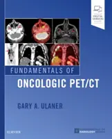 Fundamentos de Pet/CT oncológico - Fundamentals of Oncologic Pet/CT