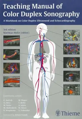 Manual de enseñanza de la ecografía dúplex en color - Teaching Manual of Color Duplex Sonography