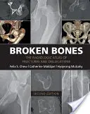 Huesos rotos: Atlas radiológico de fracturas y luxaciones - Broken Bones: The Radiologic Atlas of Fractures and Dislocations