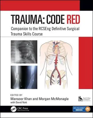 Traumatismos: Código Rojo: Curso complementario del curso Rcseng Definitive Surgical Trauma Skills Course - Trauma: Code Red: Companion to the Rcseng Definitive Surgical Trauma Skills Course