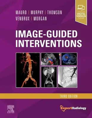 Intervenciones guiadas por imagen: Serie Radiología Experta - Image-Guided Interventions: Expert Radiology Series