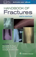 Manual de Fracturas - Handbook of Fractures