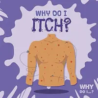 ¿Por qué pica? - Why Do I Itch?