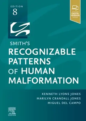 Smith'S Patrones Reconocibles de Malformación Humana - Smith'S Recognizable Patterns of Human Malformation