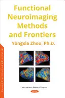 Métodos y fronteras de la neuroimagen funcional - Functional Neuroimaging Methods and Frontiers